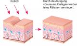 ✔ Verbesserte Direktbräune<br />
✔ Optimale Vitamin D Versorgung<br />
<strong>Mit rotem BeautyLight</strong><br />
✔ Sorgt für eine glatte und weiche Haut<br />
✔ Stimuliert die Collagenproduktion<br />
✔ Weniger Hautgeruch<br />
 <br />
<strong>Lust auf eine sanfte Bräune und eine geschmeidig zarte Haut?</strong> Das Collarium® macht‘s möglich. Das einzigartige Konzept der Lichttherapie vereint das Wirkungsspektrum von UV- und Rotlicht. Das Rotspektrum fördert die Durchblutung und verbessert dabei die UV-Verträglichkeit. Ihre ausgewogene spektrale Verteilung verbessert die Direktpigmentierung um bis zu 50%. <strong>Das Resultat ist eine glatte, sanft gebräunte Haut und eine optimale Vitamin D Versorgung.</strong><br />
 <br />
<strong>DIE URSACHEN DER HAUTALTERUNG</strong><br />
Mit steigendem Alter geht die Versorgung der Oberhaut mit Nährstoffen zurück. Das Resultat ist eine geringere Collagen- und Elastin-Produktion. Dies hat eine Erschlaffung der Haut zur Folge. Die verminderte Zellregeneration führt ausserdem zum Feuchtigkeitsverlust, Verlust von Elastizität und schliesslich zur Faltenbildung.<br />
<strong>WELCHE WIRKUNG HAT DAS ROTLICHT IN DER HAUT?</strong><br />
Klinische Studien haben gezeigt, dass sich Hautzellen bis zu 200 Prozent schneller regenerieren, wenn sie mit Collagen-Lampen behandelt werden. Das Rotlicht bekämpft also auf natürliche Weise die Ursachen der Hautalterung von innen und hemmt die Wirkung von freien Radikalen.<br />
 <br />
<strong>SO NUTZEN SIE DAS COLLARIUM® RICHTIG:</strong><br />
Wenn Sie über 4 Wochen nicht mehr an der Sonne, im Solarium oder Collarium® waren, muss die Haut zuerst wieder Pigmente aufbauen. <strong>Erst ab der 3. bis 4. Besonnung stellt sich ein Bräunungsergebnis ein, je nach Hauttyp. </strong>Der Mindestabstand zwischen den Collarium®-Besuchen sollte mindestens 2 Tage betragen. Beachten Sie die angeschlagenen Hauttyp Tabellen. Personen unter 18 Jahren ist die Nutzung untersagt.